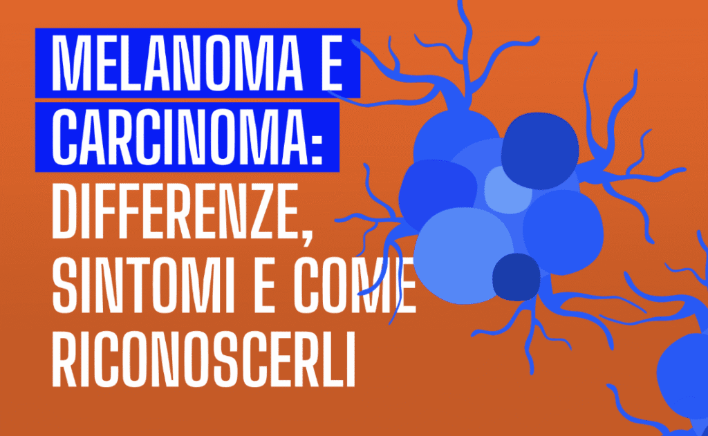 Melanoma e carcinoma non sono la stessa cosa: scopri le differenze, i segnali da non sottovalutare e quando è importante farsi controllare.